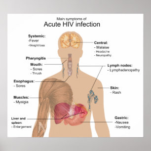 Poster Symptômes principaux de l'infection par le HIV