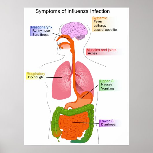 Poster Symptômes principaux d'un diagramme d'infection gr (Devant)