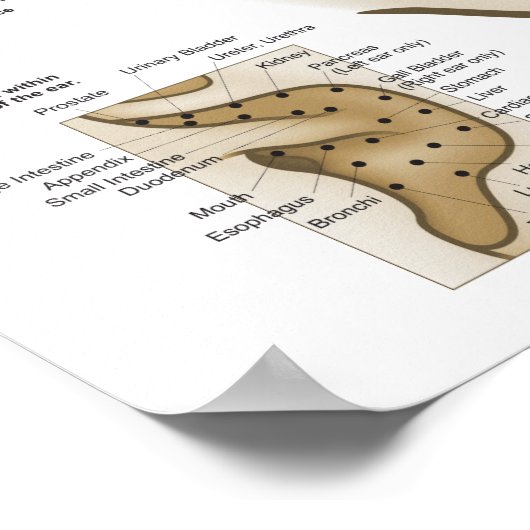 Poster Système chinois d'acupuncture auriculaire (Coin)