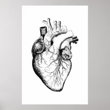 Poster ter illustratie van hartanalyse