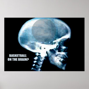 Poster Tête de basket-ball (rayon X)