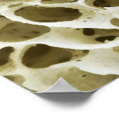 Poster Texture poreuse magnétisée de l'os hanche humain (Coin)