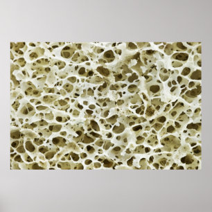 Poster Texture poreuse magnétisée de l'os hanche humain