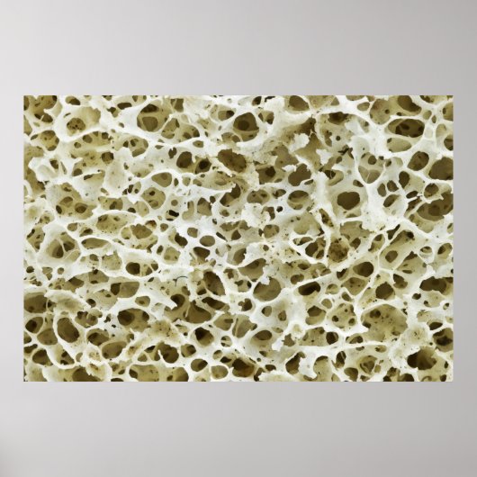 Poster Texture poreuse magnétisée de l'os hanche humain (Devant)