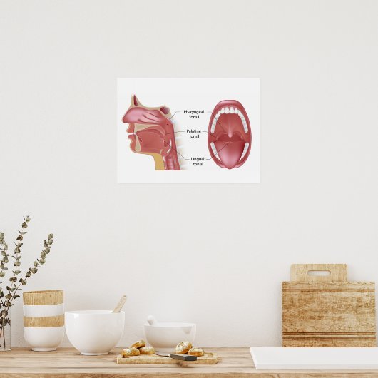 Poster tonsils (Keuken)