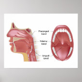 Poster tonsils (Voorkant)