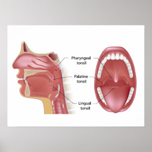 Poster tonsils