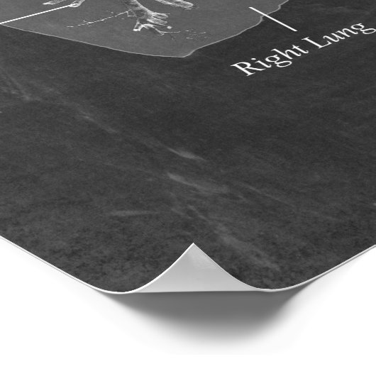 Poster Trachée d'anatomie pulmonaire et Bronchi (Coin)