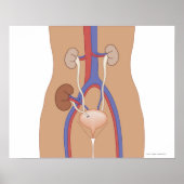 Poster Transplantation rénale (Devant)