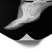 Poster Trump Bone Spur Ink Pen Funny Anti Trump  (Coin)