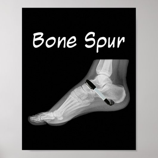 Poster Trump Bone Spur Ink Pen Funny Anti Trump  (Devant)