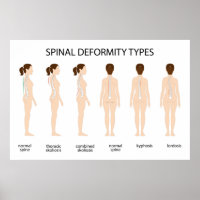 Types de déformation de la colonne vertébrale