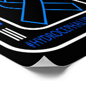 Poster Un échec de sensibilisation se produit Neurosurge (Coin)