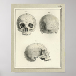 Poster Vintage 1831 Anatomie du crâne humain Imprimer