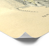 Poster Vintage Frohse Anatomique Lumbar Spine (Coin)