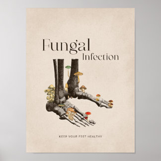 Poster Vintage Infection fongique soins aux pieds