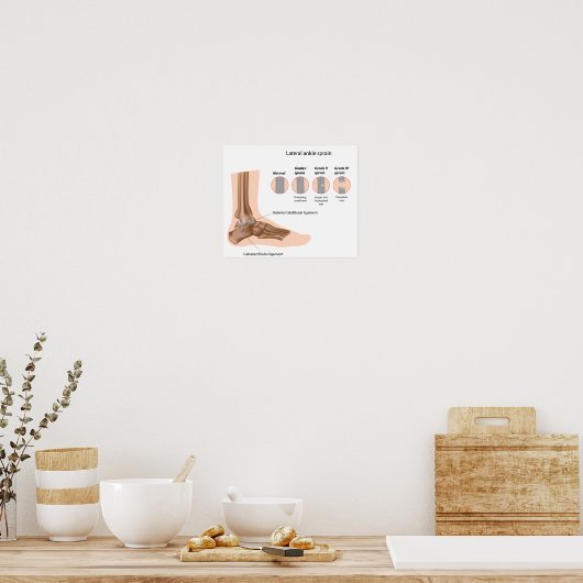 Poster voor het indelen van zijdelingse enkels (Keuken)