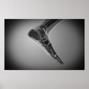 Poster Vue de rayon X du pied humain 4