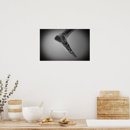 Poster Vue En Rayon X Du Pied Humain 4 (Cuisine)