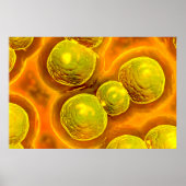 Poster Vue Microscopique De Chlamydia (Devant)