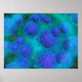 Poster Vue Microscopique Du Diplococcus Bacterium (Devant)