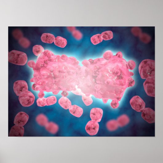 Poster Vue Microscopique D'Un Groupe De Cellules Leucémiq (Devant)