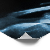 POSTER - X-RAY MUZIEK SKELETON BLACK BLUE (Hoek)