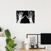 Poster X-Ray Skeleton Mains et bijoux - B&W (Bureau à domicile)