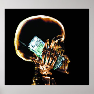 POSTER - X-RAY SKELETON OP DE OORSPRONKELIJKE TELE