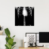 POSTER X-RAY SKELETON TORSO RIBS - B&W (Bureau à domicile)