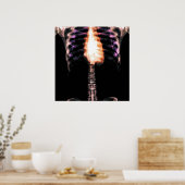 POSTER X-RAY SKELETON TORSO RIBS - ORIGINAL (Cuisine)