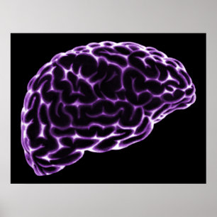 POSTER XRAY CÔTÉ CERVEAU VUE PURPLE