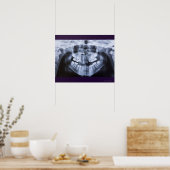 Poster Xray d'une mâchoire fillette prise avec le panoram (Cuisine)