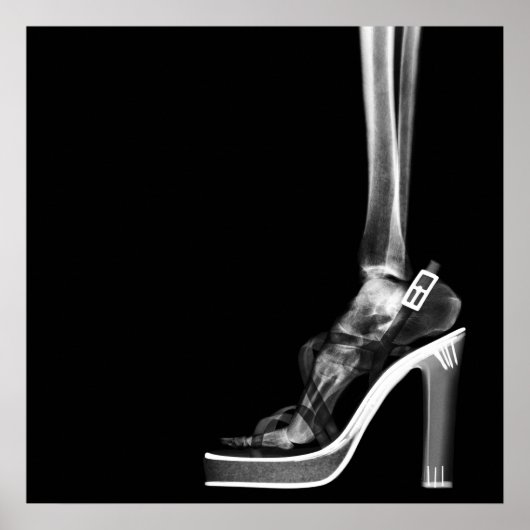 POSTER XRAY HIGEL LADY SKELETON FOOT B&W (Devant)