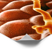 Powdery Mildew Fungus over Poinsettia Poster (Hoek)