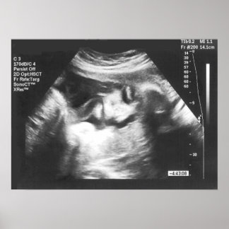 Prank Fake Ultrasound Afbeelding Poster