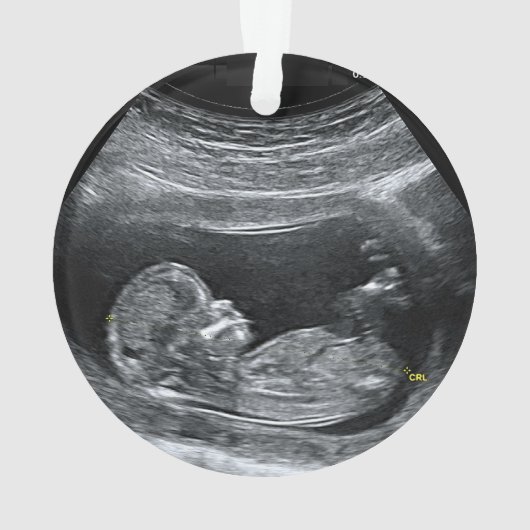 Premier Noël du bébé (dos)