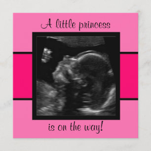 Princess Baby Gepersonaliseerd echografiefotomplat Kaart