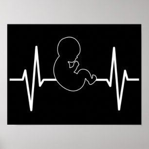 Pro-Life Baby hartslag Pulse EKG: Christelijk gelo Poster