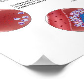 Progression de la tuberculose pulmonaire Poster (Coin)