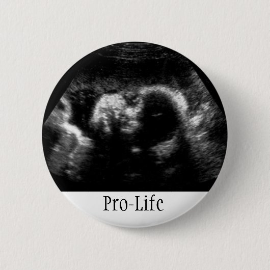 ProLife Ronde Button 5,7 Cm (Voorkant)