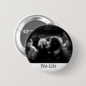 ProLife Ronde Button 5,7 Cm (Voorkant /achterkant)