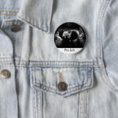 ProLife Ronde Button 5,7 Cm (In situ)