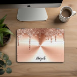 Protection iPad Pro Cover Parties scintillant de Rose d'or Sparkle de luxe p<br><div class="desc">Belle Parties scintillant Rose à goutte d'or de luxe avec texture en métal brossé design personnalisé iPad Pro</div>