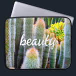 Protection Pour Ordinateur Portable Fuzzy Green Cactus Succulent Photo Script Beauté<br><div class="desc">Les cactus poussent dans les conditions désertiques les plus dures. Rêvez des jours ensoleillés et de la beauté d’un jardin d’été chaque fois que vous utilisez cette étonnante pochette d’ordinateur portable en néoprène photographie. Cette pochette pour ordinateur portable est disponible en trois tailles : 15", 13" et 10". Fait un...</div>