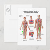 Pulmonaire embolie, route van embolus briefkaart (Voorkant / Achterkant)
