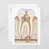 Pulp- en wortelabscess briefkaart (Voorkant / Achterkant)