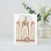 Pulp- en wortelabscess briefkaart (Staand voorkant)