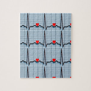 Puzzle Bandes EKG