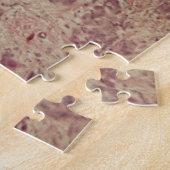 Puzzle Cancer du sein sous le microscope (Côté)